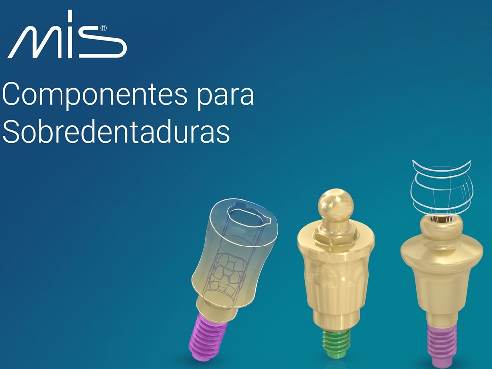 Sistemas de Retención para Sobredentaduras MIS